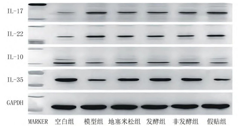 空白組和支氣管哮喘各組大鼠肺組織中IL－17、IL－22、IL－10、IL－35蛋白表達(dá)電泳圖